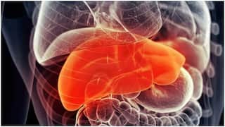 Early Signs of Liver Issues : కాలేయ వాపు ప్రధాన లక్షణాలు ఇవే.. నిర్లక్ష్యం చేస్తే ప్రాణాంతకమే