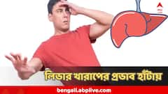 খেয়াল করেছেন, হাঁটতে গিয়ে এইভাবে পা ফেলছেন না তো! লিভারের বারোটা বাজার ইঙ্গিত এটাই
