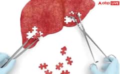 Early Signs of Liver disease: ਬਿਸਤਰੇ 'ਤੇ ਲੇਟਦਿਆਂ ਹੀ ਦਿਖਦੇ ਲੀਵਰ 'ਚ ਸੋਜ ਦੇ ਆਹ ਲੱਛਣ, 99% ਲੋਕ ਲਾ ਲੈਂਦੇ ਮੌਤ ਨੂੰ ਗਲੇ