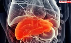 ਪੈਰਾਂ 'ਚ ਦਿਖਣ ਲੱਗੇ ਆਹ ਲੱਛਣ ਤਾਂ ਸਮਝ ਜਾਓ ਬਲਾਕ ਹੋ ਗਈਆਂ ਨਸਾਂ, ਤੁਰੰਤ ਜਾਓ ਡਾਕਟਰ ਕੋਲ