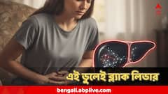 কালো ঝুল হয়ে যাবে লিভার! কাড়তে পারে প্রাণও, এই মারাত্মক ভুল করলেই ব্ল্যাক লিভার ডিজিজ