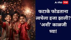 Diwali 2025 : फटाके फोडताना त्वचेला इजा झाली? 'अशी' काळजी घ्या! सोप्या टिप्स..