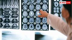 सिर में सिर्फ दर्द है या ब्रेन ट्यूमर ने कर ली एंट्री? इन वॉर्निंग सिग्नल से पता लगती है असली प्रॉब्लम