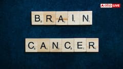 Early signs of brain cancer: ये 5 लक्षण दिखें तो गलती से भी सिरदर्द मत समझ लेना, ब्रेन कैंसर के होते हैं सिग्नल