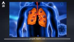 ਫੇਫੜਿਆਂ ਨੂੰ ਖਾ ਜਾਏਗੀ ਇਹ ਬਿਮਾਰੀ! ਇਨ੍ਹਾਂ ਘਰੇਲੂ ਨੁਸਖਿਆਂ ਨਾਲ ਰਹੇਗੀ ਦੂਰ