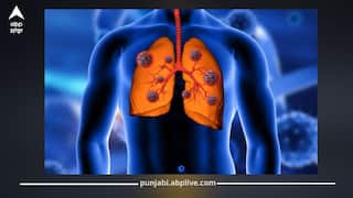 ਫੇਫੜਿਆਂ ਨੂੰ ਖਾ ਜਾਏਗੀ ਇਹ ਬਿਮਾਰੀ! ਇਨ੍ਹਾਂ ਘਰੇਲੂ ਨੁਸਖਿਆਂ ਨਾਲ ਰਹੇਗੀ ਦੂਰ