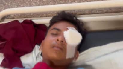 Madhya Pradesh: 14 Children Go Blind After Playing With ‘Carbide Gun’ During Diwali