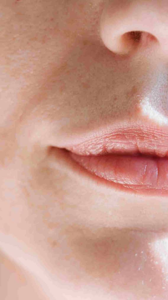 শীতে ঠোঁট ফেটে চৌচির ? সহজ এই ঘরোয়া উপায়েই মুশকিল আসান !