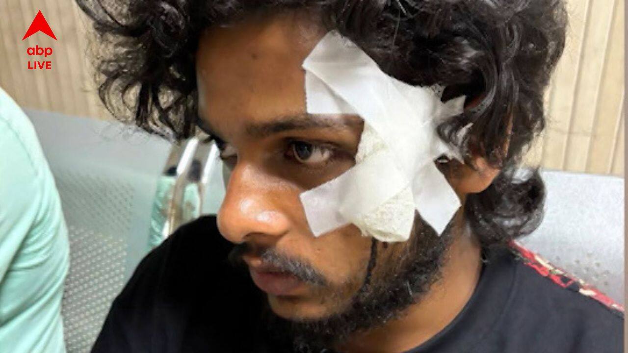 Malda News: ইঞ্জিনিয়ারিং ছাত্রকে তৃণমূল কার্যালয়ে তুলে নিয়ে গিয়ে মারধরের অভিযোগ মহিলা কাউন্সিলারের বিরুদ্ধে