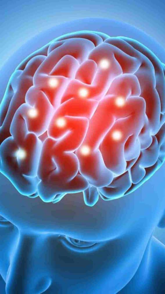 ब्रेन ट्यूमर में दिखते हैं ये 7 शुरुआती लक्षण