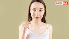 चेहरे पर पिंपल्स के निशान नहीं जा रहे, इसे ऐसे कर सकते हैं जड़ से खत्म?