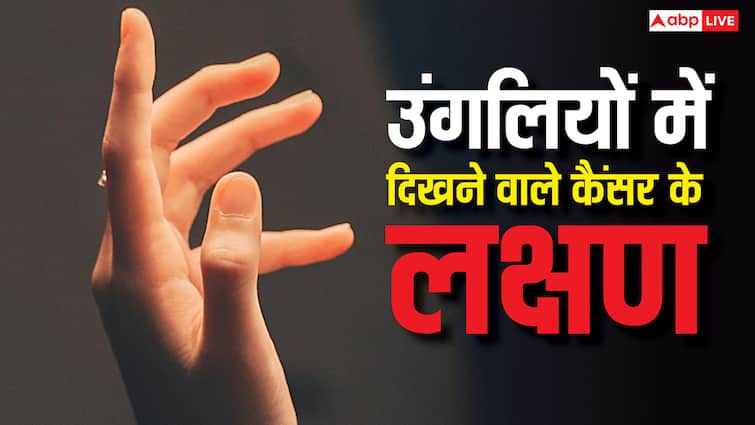 उंगलियों और नाखूनों में दिखते हैं लंग कैंसर के ये लक्षण, इन्हें गलती से भी न करना इग्नोर उंगलियों और नाखूनों में दिखते हैं लंग कैंसर के ये लक्षण, इन्हें गलती से भी न करना इग्नोर