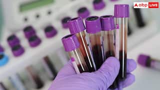 ये तीन टेस्ट करा लिए तो बच सकती है किसी की भी जान, जरूर करवा लें इन्हें