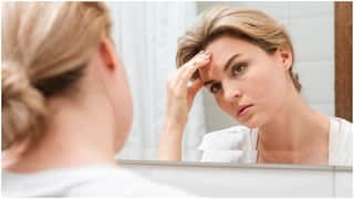 Fatty Liver Symptoms on Face : ముఖంలో ఈ మార్పులు వస్తున్నాయా? అయితే అవి కాలేయంలో కొవ్వుకి సంకేతాలు కావొచ్చు, జాగ్రత్త