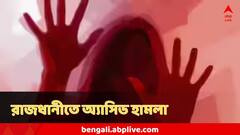 দিল্লিতে ভয়ঙ্কর ঘটনা! ইউনিভার্সিটি যাওয়ার রাস্তাতেই ছোড়া হল অ্যাসিড, ঝলসে গেল ...