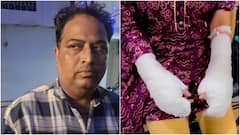 Delhi ‘Acid Attack’ Case Turns Out Fake, Woman's Father Arrested For Plot Using Toilet Cleaner