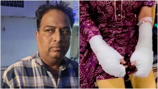 Delhi Acid Attack: Victim's Father Arrested As Accused Claims Woman Poured Toilet Cleaner On Her Hands