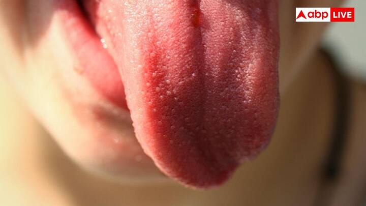 हर मानव जीभ में पैपिला, लकीरें और खांचे का एक खास पैटर्न होता है. यह पैटर्न जीवन भर स्थिर रहता है उंगलियों के निशान की ही तरह.