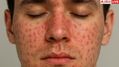 बाल तोड़ किन लोगों को होता है जल्दी, हमारे शरीर के लिए यह कितना खतरनाक?