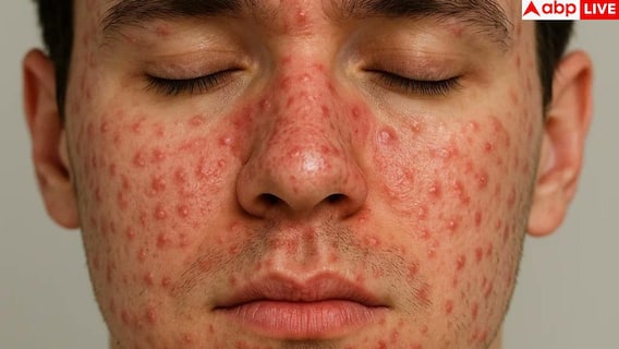 Who gets Baltod First: बाल तोड़ किन लोगों को होता है जल्दी, हमारे शरीर के लिए यह कितना खतरनाक?