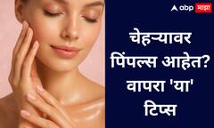 Pimple Free Skin : पिंपल्ससाठी प्रभावी आणि वैज्ञानिक स्किनकेअर टिप्स!