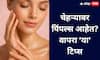 Pimple Free Skin : पिंपल्ससाठी प्रभावी आणि वैज्ञानिक स्किनकेअर टिप्स!