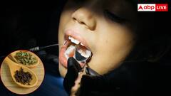 नीम से लेकर लौंग तक... दांतों और मसूड़ों को हेल्दी रखने के लिए ये हैं असरदार तरीके 