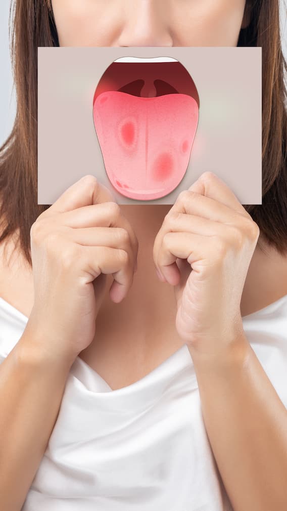 8 Common Causes Behind Frequent Mouth Ulcers You Shouldn’t Ignore
