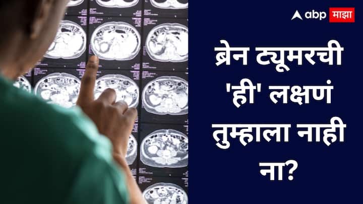 Symptoms of brain tumor : दररोज होणारी आणि औषधांनी न कमी होणारी तीव्र डोकेदुखी ही ब्रेन ट्यूमर किंवा मेंदूतील रक्तस्त्रावाचे संकेत असू शकते त्यामुळे अशी समस्या जाणवल्यास त्वरित डॉक्टरांचा सल्ला घ्या.
