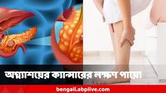 ধরা পড়তেই বড্ড দেরি হয়ে যায়! পেট ব্যথা ছাড়াও এই সব লক্ষণে চিনুন অগ্ন্যাশয়ের ক্যান্সার