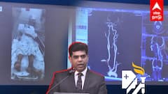 ‘ADVANCED STROKE NETWORK’ பக்கவாத நோய் பயமா?அப்போலோவின் புதிய முயற்சி | Apollo Advanced Stroke Network