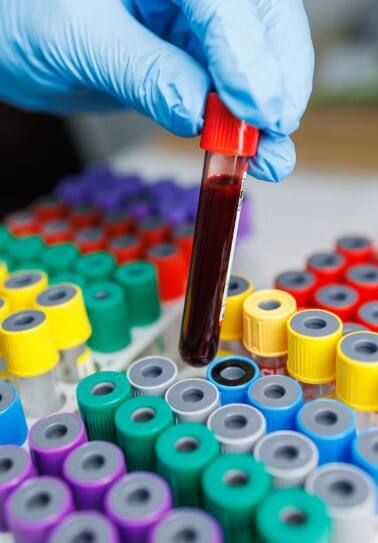 ਇਸ ਬਲੱਡ ਗਰੁੱਪ ਵਾਲਿਆਂ ਨੂੰ ਦਿਲ ਦੇ ਦੌਰੇ ਦਾ ਖ਼ਤਰਾ ਸਭ ਤੋਂ ਘੱਟ, ਰਿਪੋਰਟ ‘ਚ ਹੈਰਾਨੀਜਨਕ ਖੁਲਾਸਾ