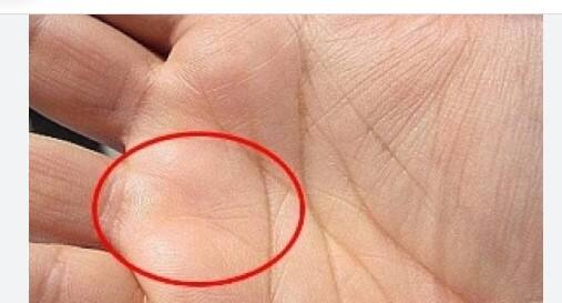 ਸੂਰਜ ਰੇਖਾ  ਹਸਤ ਰੇਖਾ ਵਿੱਚ ਸੂਰਜ ਦੀ ਛੋਟੀ ਰੇਖਾ ਵੀ ਧਨ ਯੋਗ ਵਿੱਚ ਯੋਗਦਾਨ ਪਾਉਂਦੀ ਹੈ। ਇਹ ਰੇਖਾ ਕਾਰੋਬਾਰ ਅਤੇ ਕਰੀਅਰ ਵਿੱਚ ਤੇਜ਼ੀ ਨਾਲ ਤਰੱਕੀ ਨੂੰ ਦਰਸਾਉਂਦੀ ਹੈ। ਇਸ ਚਿੰਨ੍ਹ ਵਾਲੇ ਲੋਕ ਨਵੇਂ ਮੌਕਿਆਂ ਨੂੰ ਜਲਦੀ ਪਛਾਣਦੇ ਹਨ ਅਤੇ ਸਮੇਂ ਸਿਰ ਉਨ੍ਹਾਂ ਨੂੰ ਹਾਸਲ ਕਰਦੇ ਹਨ।