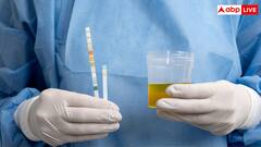 टॉयलेट करते समय आता है झाग तो इसे न करें नजरअंदाज, किडनी खराब होने के हो सकते हैं संकेत