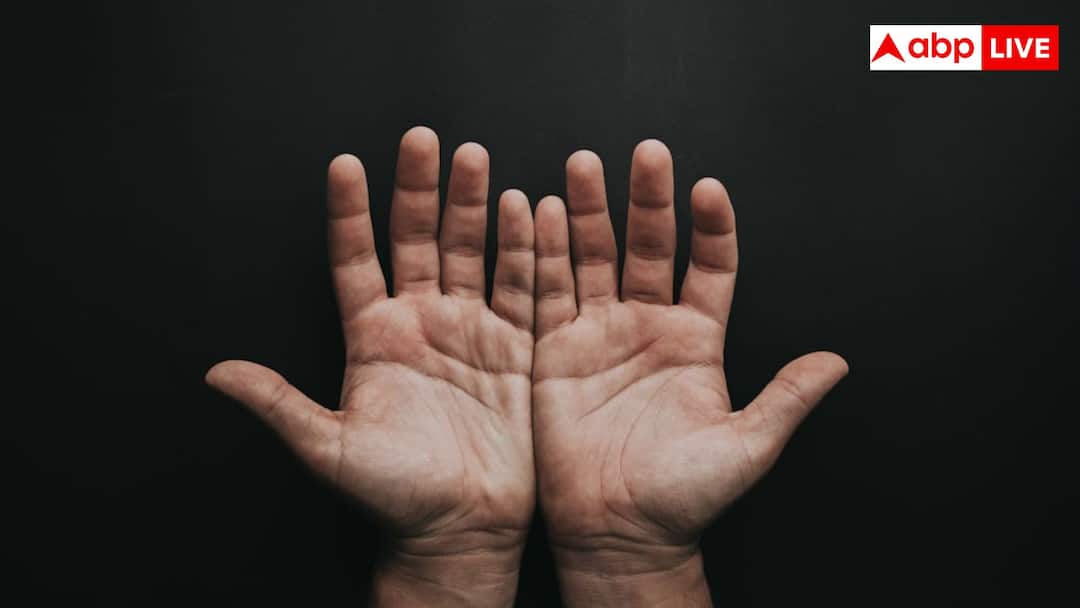 why do fingers and toes swell in winter and how to prevent cold weather swelling and itching क्या ठंड शुरू होते ही सूज जाती हैं हाथ-पैर की उंगलियां, जानिए क्या है दिक्कत