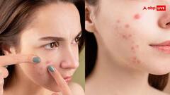 क्या बाल तोड़ से हो सकती है मौत, जानें किस स्टेज में होती है यह दिक्कत?