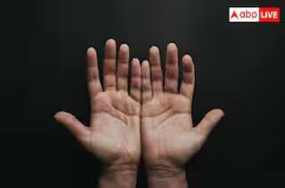 Health: શિયાળામાં ઠંડી શરૂ થવાની સાથે શરૂ થાય છે આ સમસ્યા, જાણો ઉપાય