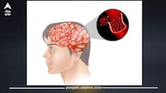 ਸਬਜ਼ੀਆਂ ਤੋਂ ਦਿਮਾਗ 'ਚ ਪਹੁੰਚ ਸਕਦਾ ਕੀੜਾ? ਨਿਊਰੋਲਾਜਿਸਟ ਨੇ ਦੱਸਿਆ ਕਿਵੇਂ ਕਰੋ ਸਬਜ਼ੀਆਂ ਦੀ ਸਫ਼ਾਈ