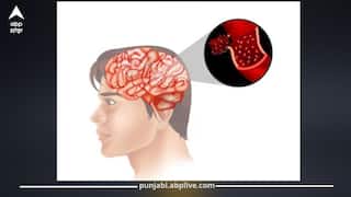 เจธเจฌเจเจผเฉเจเจ เจคเฉเจ เจฆเจฟเจฎเจพเจ 'เจ เจชเจนเฉเฉฐเจ เจธเจเจฆเจพ เจเฉเฉเจพ? เจจเจฟเจเจฐเฉเจฒเจพเจเจฟเจธเจ เจจเฉ เจฆเฉฑเจธเจฟเจ เจเจฟเจตเฉเจ เจเจฐเฉ เจธเจฌเจเจผเฉเจเจ เจฆเฉ เจธเจซเจผเจพเจ