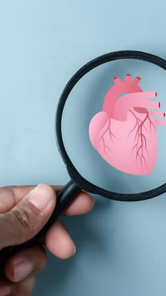 જો આ 4 લક્ષણો દેખાય તો કરાવવી પડી શકે છે એન્જીયોપ્લાસ્ટી