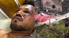 ‘It’s A Miracle, But I Lost Everything’: Sole Survivor Of Air India AI-171 Crash Speaks Of His Tragedy