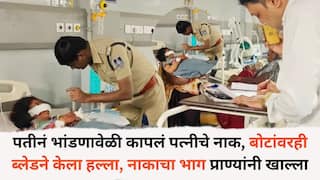 Shocking incident: धक्कादायक... पतीनं भांडणावेळी कापलं पत्नीचे नाक, बोटांवरही ब्लेडने केला हल्ला, नाकाचा भाग प्राण्यांनी खाल्ला, नेमकं काय घडलं?