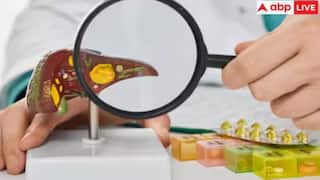 Liver Health: તમારા લીવરને કુદરતી રીતે રાખો સ્વસ્થ, આ ઘરેલું ઉપાયથી થશે લાભ