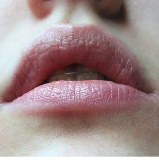 ਸੁੱਕੇ-ਫੱਟੇ ਬੁੱਲਾਂ ਨੂੰ ਨਰਮ ਬਣਾਉਣ ਲਈ ਅਸਰਦਾਰ ਘਰੇਲੂ ਨੁਸਖੇ