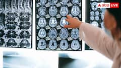 35 से 45 उम्र में हो गईं हार्ट की बीमारियां तो डिमेंशिया का भी बढ़ेगा खतरा, इस स्टडी में डराने वाला खुलासा