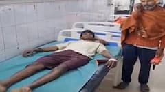 कोबरा ने युवक को डसा तो गुस्से में चबा डाला सांप का फन, परिजनों को हॉस्पिटल में करना पड़ा भर्ती