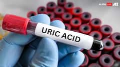 યુરિક એસિડનું લેવલ વધી જાય તો શરીરમાં આ લક્ષણો જોવા મળે, આ રીતે છૂટકારો મેળવો