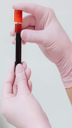 'या' जनावरांचे रक्त लाल नव्हे, पिवळे असते!