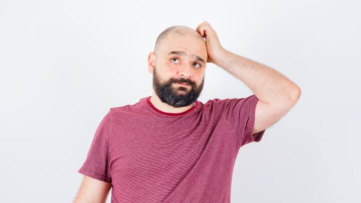 Balding Signs at 20: সময় থাকতেই সতর্ক হোন। লক্ষণ দেখলেই চিকিৎসকের পরামর্শ নিন। ছবি: ফ্রিপিক।
