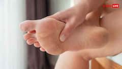 सर्दी में फटने लगी हैं एड़ियां, महंगी क्रीम नहीं ये घरेलू नुस्खे आएंगे काम